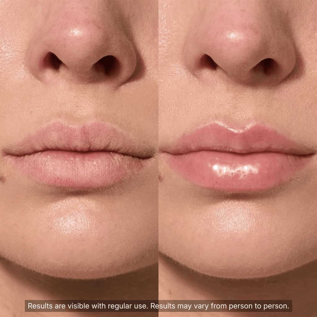 Soft Glow Collagen Balm Stick - Cozevi