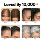 Korea's 1 Hair Growth Serum - Cozevi