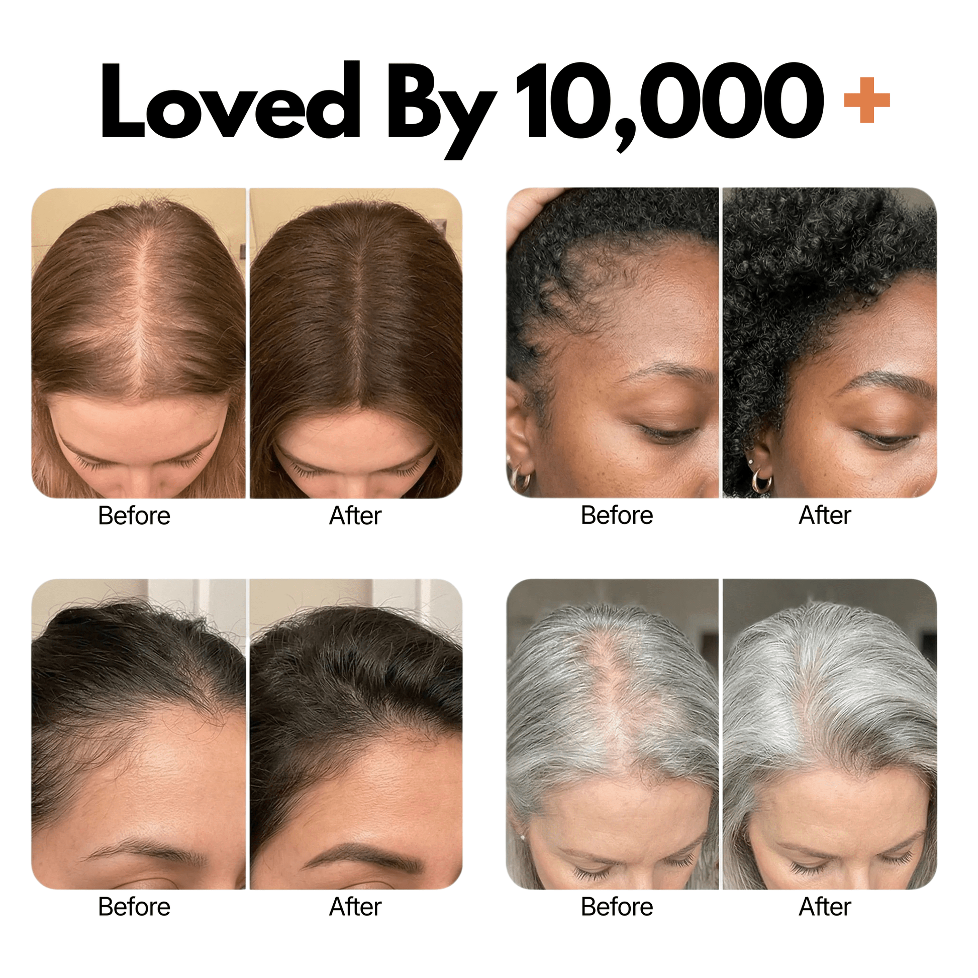 Korea's 1 Hair Growth Serum - Cozevi